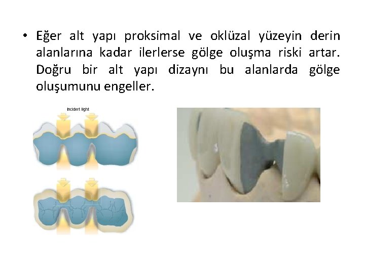  • Eğer alt yapı proksimal ve oklüzal yüzeyin derin alanlarına kadar ilerlerse gölge