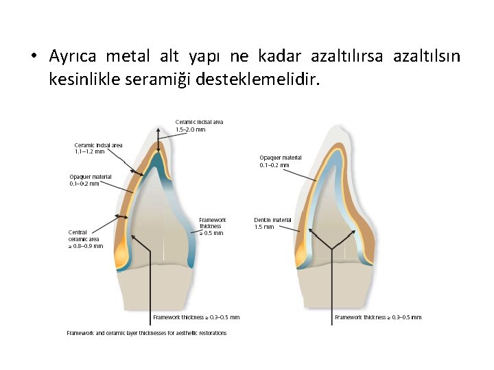  • Ayrıca metal alt yapı ne kadar azaltılırsa azaltılsın kesinlikle seramiği desteklemelidir. 