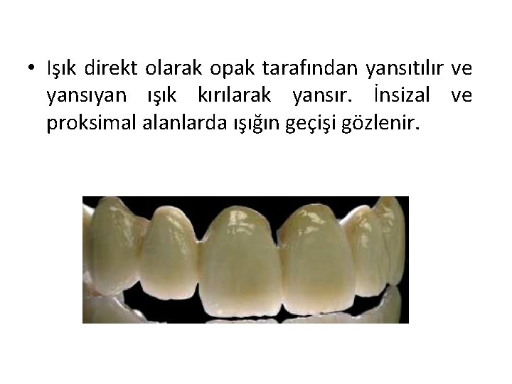  • Işık direkt olarak opak tarafından yansıtılır ve yansıyan ışık kırılarak yansır. İnsizal