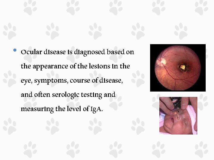  • Ocular disease is diagnosed based on the appearance of the lesions in