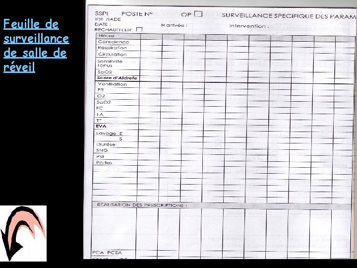 Feuille de surveillance de salle de réveil ANN 7 Feuille de surveillance de salle de réveil ANN 7