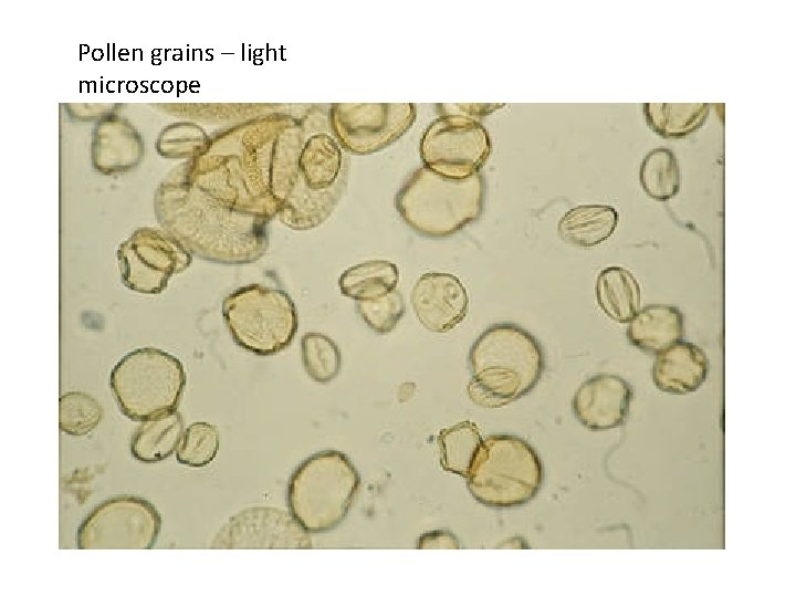 Pollen grains – light microscope 