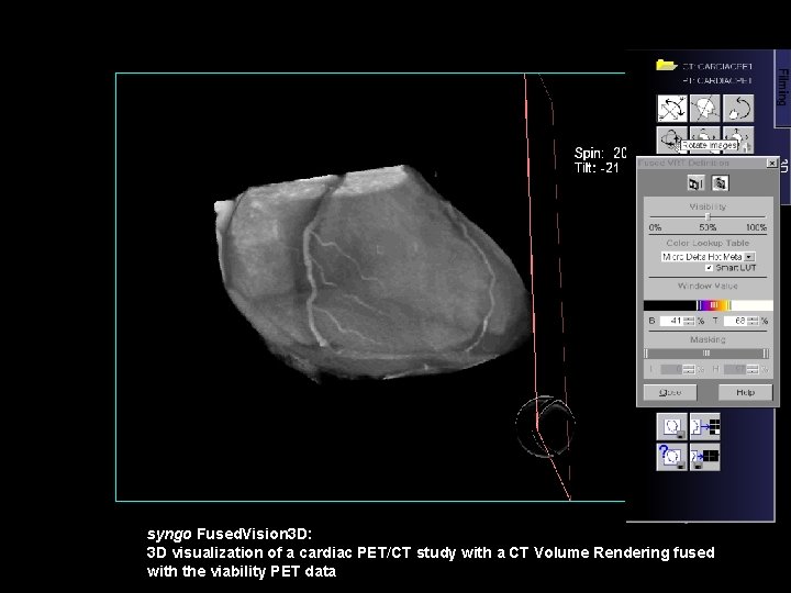 1 Sustainable Supply Chains at Siemens Medical KUMARI
