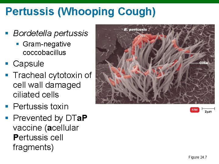 Pertussis (Whooping Cough) § Bordetella pertussis § Gram-negative coccobacillus § Capsule § Tracheal cytotoxin