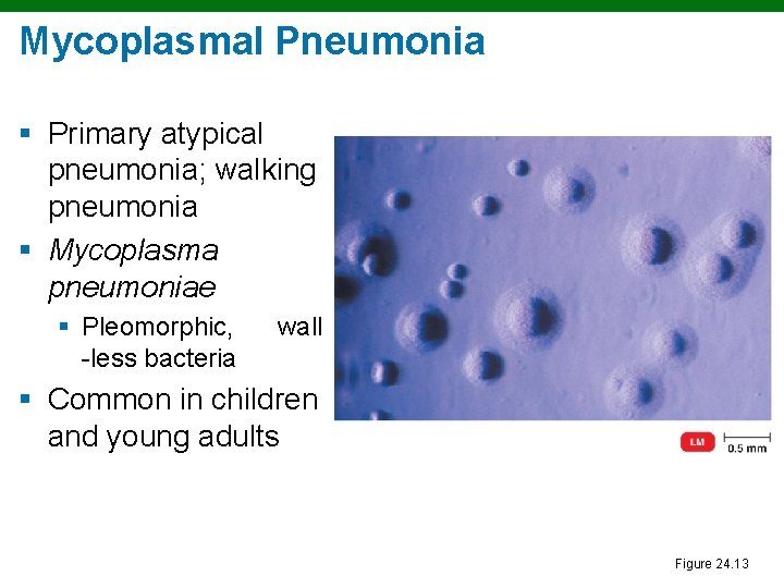 Mycoplasmal Pneumonia § Primary atypical pneumonia; walking pneumonia § Mycoplasma pneumoniae § Pleomorphic, -less