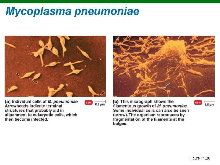 Mycoplasma pneumoniae Figure 11. 20 