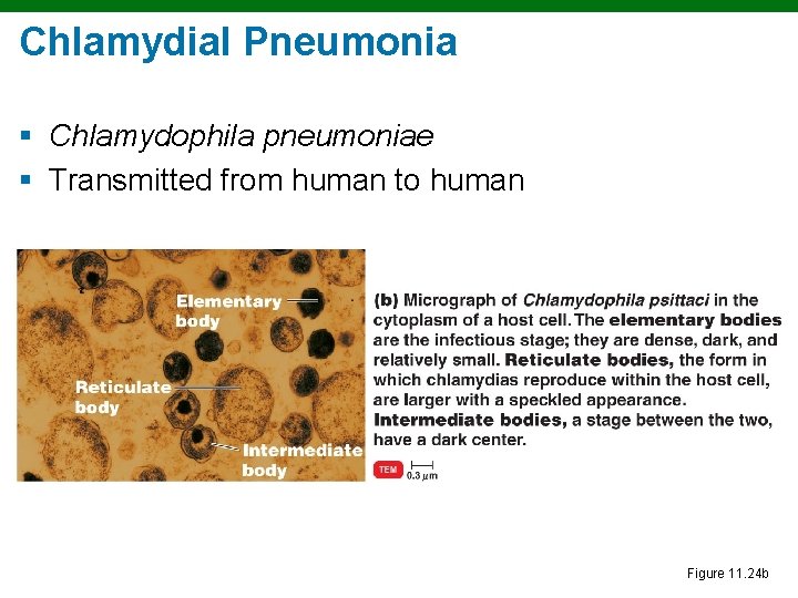 Chlamydial Pneumonia § Chlamydophila pneumoniae § Transmitted from human to human Figure 11. 24