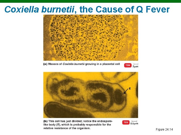 Coxiella burnetii, the Cause of Q Fever Figure 24. 14 