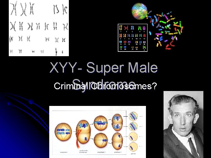 XYY- Super Male Criminal Chromosomes? Syndrome 