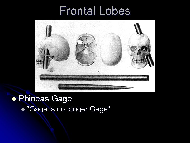 Frontal Lobes l Phineas Gage l “Gage is no longer Gage” 