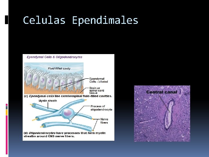 Celulas Ependimales 