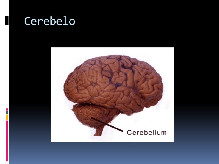 Cerebelo 