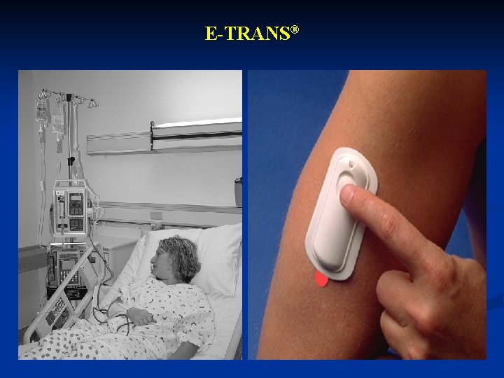 E-TRANS® 