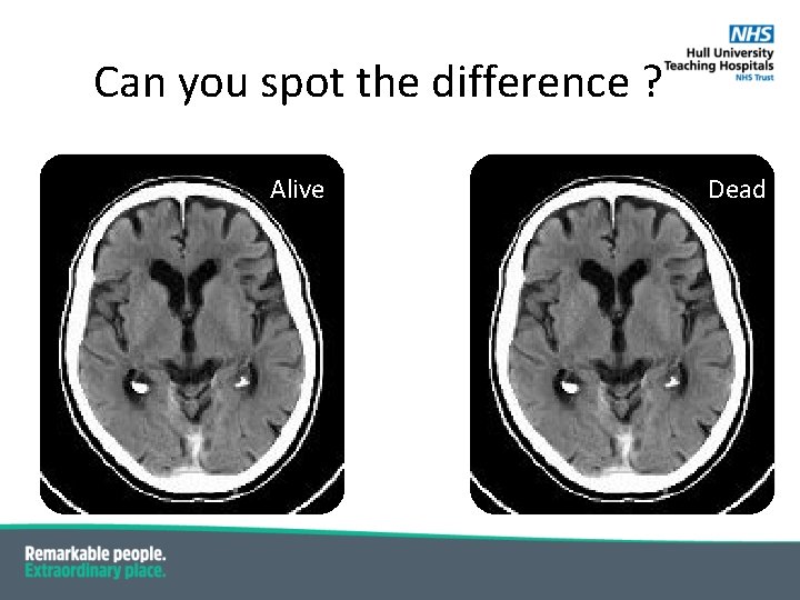 Can you spot the difference ? Alive Dead Can you spot the difference ? Alive Dead