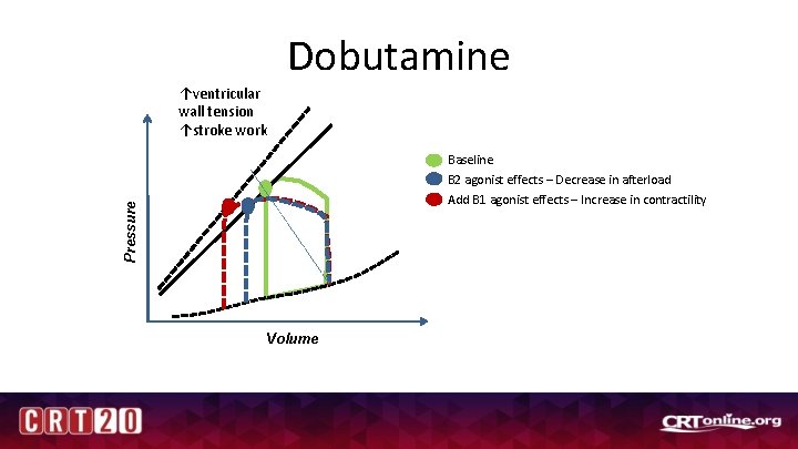 Dobutamine ↑ventricular wall tension ↑stroke work Baseline B 2 agonist effects – Decrease in