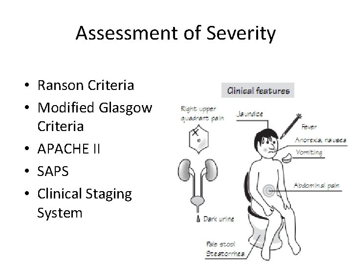 Assessment of Severity • Ranson Criteria • Modified Glasgow Criteria • APACHE II •
