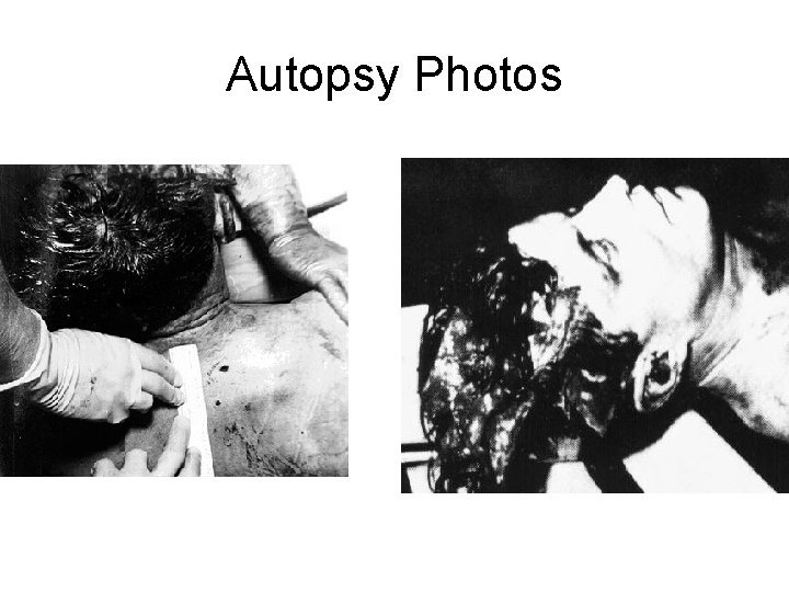 Autopsy Photos 