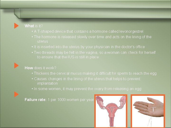 What is it? • A T-shaped device that contains a hormone called levonorgestrel •