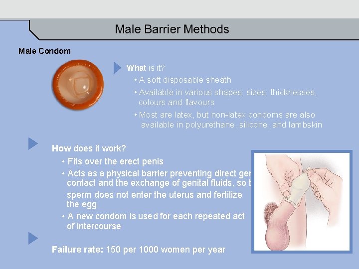 Male Condom What is it? • A soft disposable sheath • Available in various