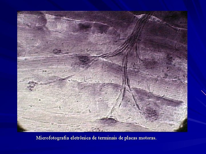 Microfotografia eletrônica de terminais de placas motoras. 