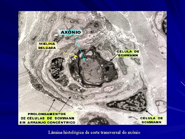 Lâmina histológica de corte transversal do axônio 