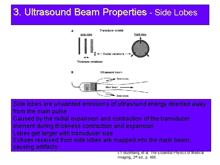 3. Ultrasound Beam Properties - Side Lobes Side lobes are unwanted emissions of ultrasound