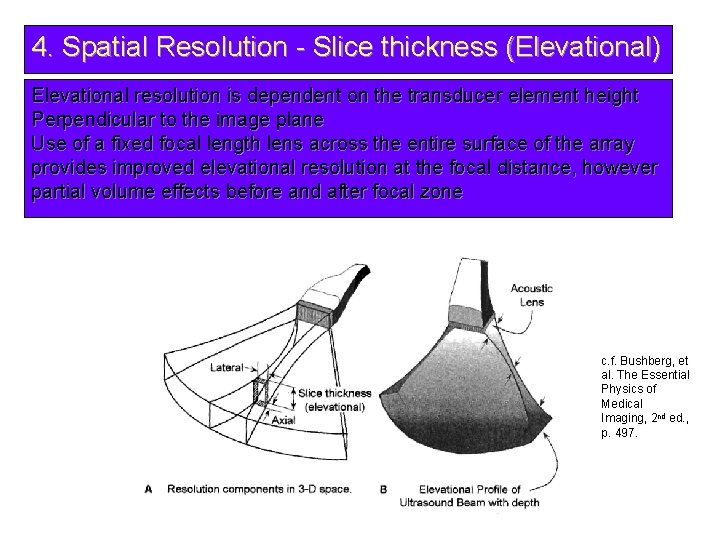 4. Spatial Resolution - Slice thickness (Elevational) Elevational resolution is dependent on the transducer