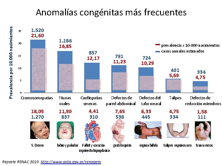 Prevalencia por 10. 000 nacimientos Anomalías congénitas más frecuentes 25 1. 520 21, 60