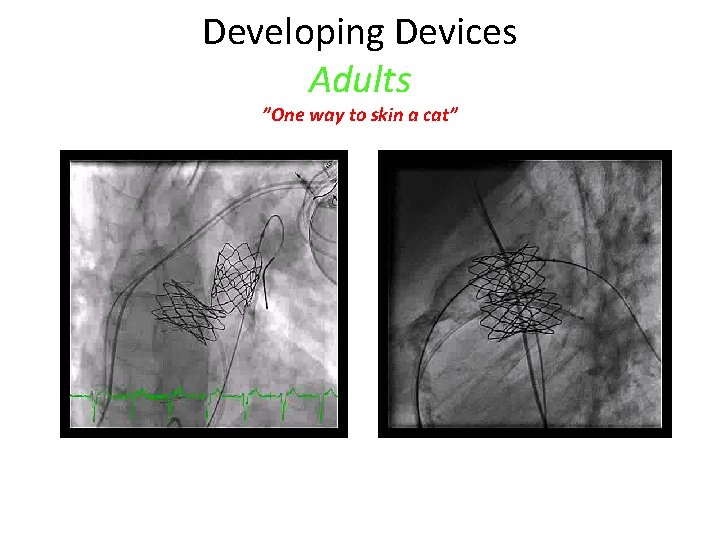 Developing Devices Adults ”One way to skin a cat” 