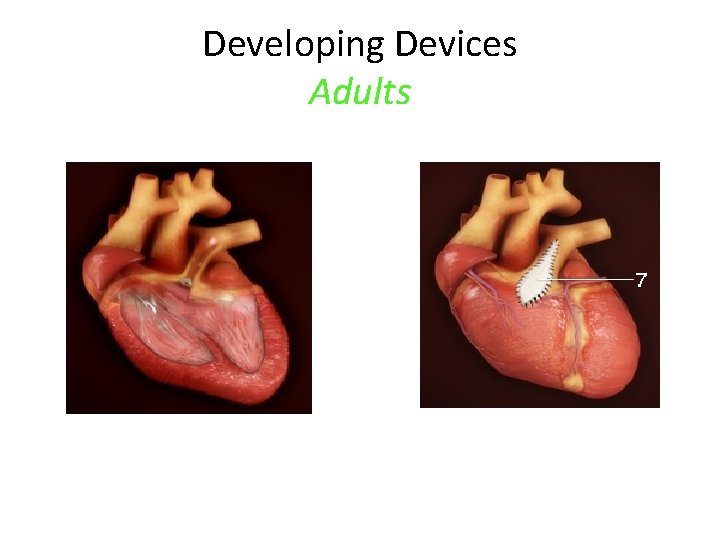 Developing Devices Adults 