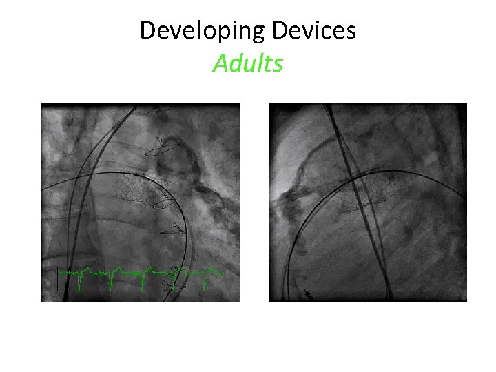 Developing Devices Adults 