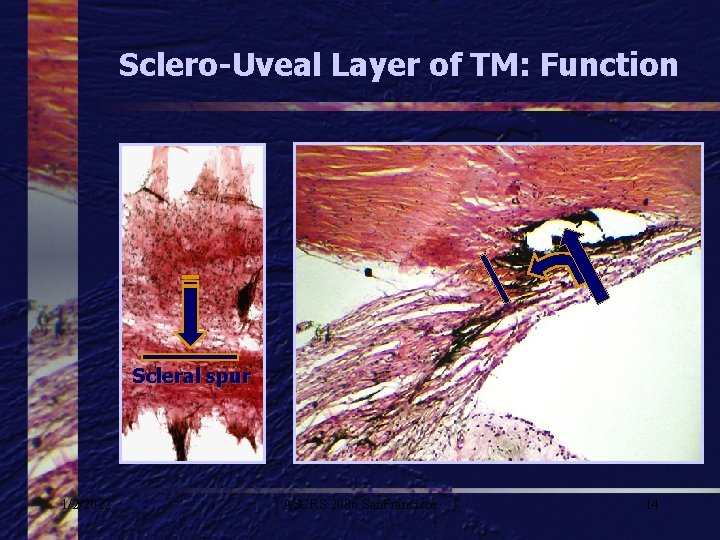 Sclero-Uveal Layer of TM: Function Scleral spur 1/2/2022 ASCRS 2006 San. Francisco 14 