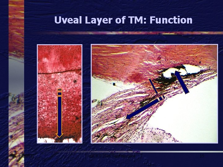 Uveal Layer of TM: Function 1/2/2022 ASCRS 2006 San. Francisco 15 