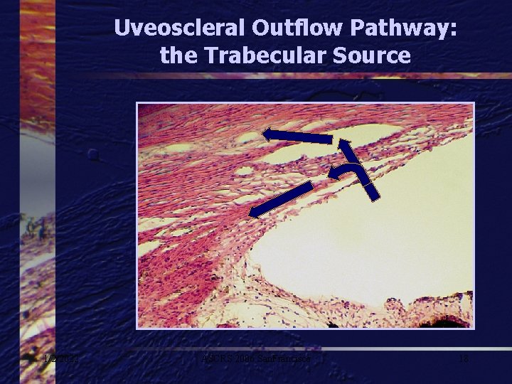 Uveoscleral Outflow Pathway: the Trabecular Source 1/2/2022 ASCRS 2006 San. Francisco 18 