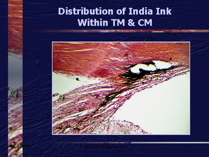 Distribution of India Ink Within TM & CM 1/2/2022 ASCRS 2006 San. Francisco 8
