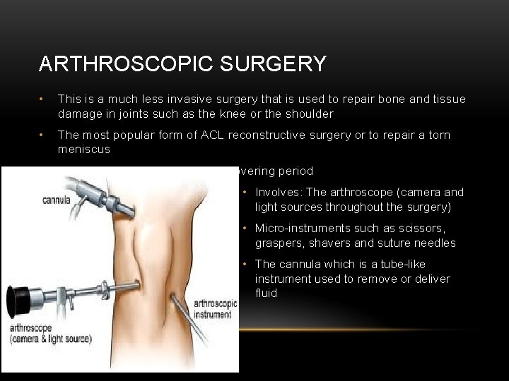 ARTHROSCOPIC SURGERY • This is a much less invasive surgery that is used to