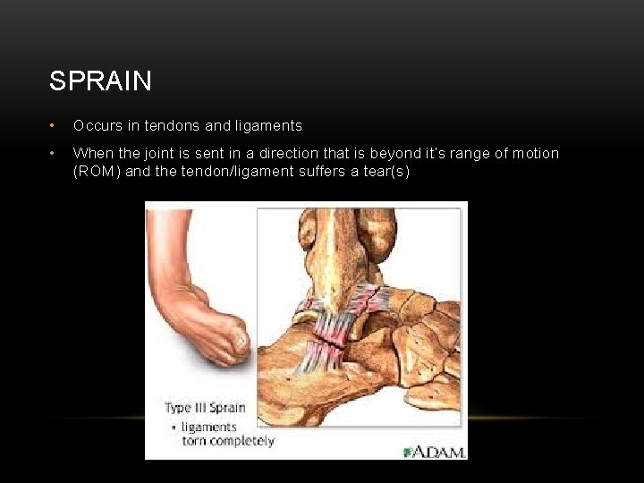 SPRAIN • Occurs in tendons and ligaments • When the joint is sent in