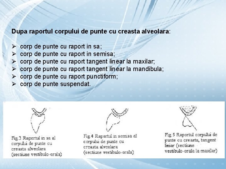 Dupa raportul corpului de punte cu creasta alveolara: Ø Ø Ø corp de punte