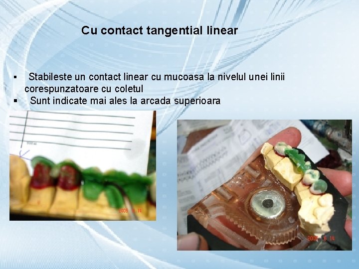 Cu contact tangential linear Stabileste un contact linear cu mucoasa la nivelul unei linii