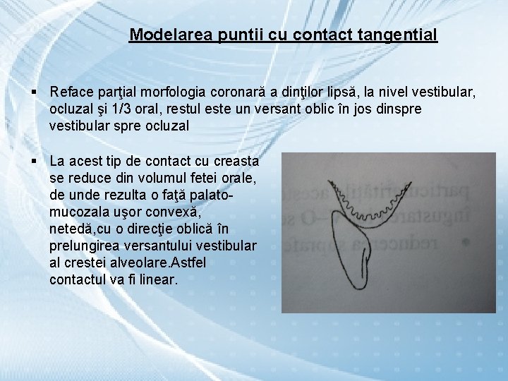 Modelarea puntii cu contact tangential § Reface parţial morfologia coronară a dinţilor lipsă, la