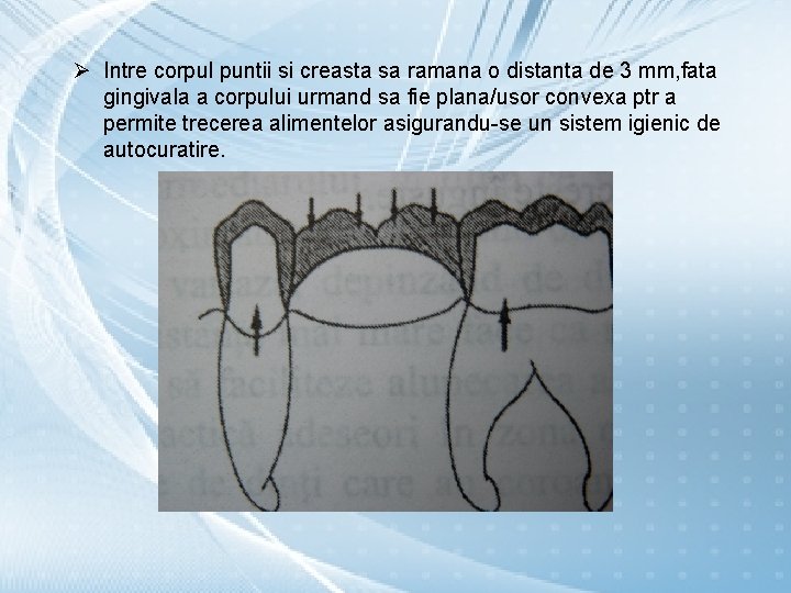 Ø Intre corpul puntii si creasta sa ramana o distanta de 3 mm, fata