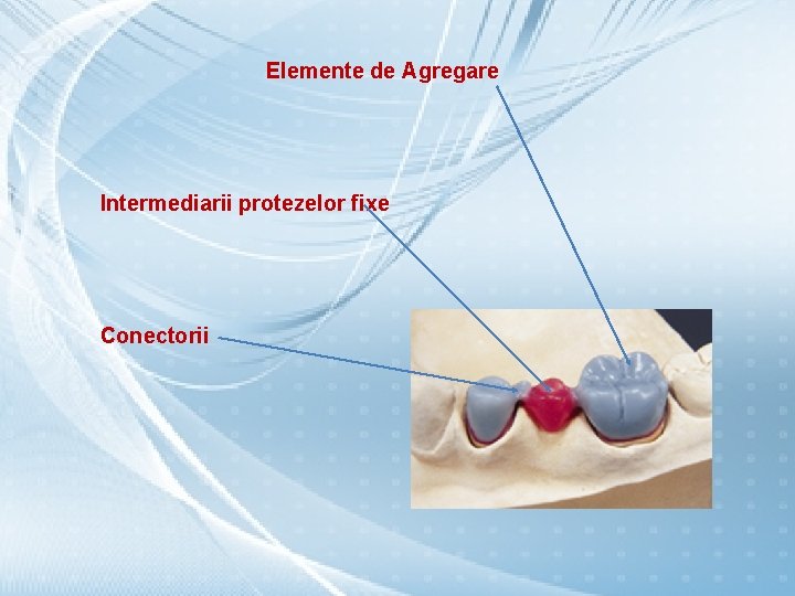Elemente de Agregare Intermediarii protezelor fixe Conectorii 