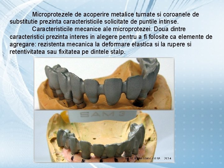 Microprotezele de acoperire metalice turnate si coroanele de substitutie prezinta caracteristicile solicitate de puntile