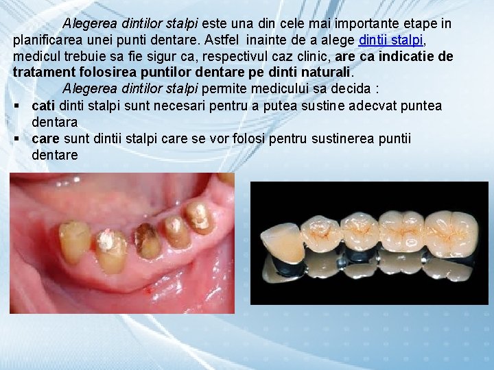 Alegerea dintilor stalpi este una din cele mai importante etape in planificarea unei punti