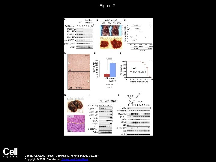 Figure 2 Cancer Cell 2009 16425 -438 DOI: (10. 1016/j. ccr. 2009. 026) Copyright