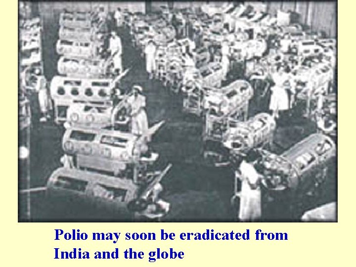 Polio may soon be eradicated from India and the globe 