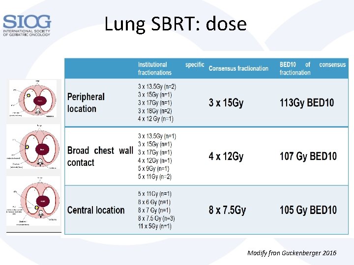 Lung SBRT: dose Modify fron Guckenberger 2016 