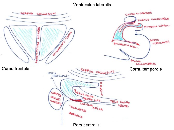 Ventriculus lateralis Cornu frontale Cornu temporale Pars centralis 