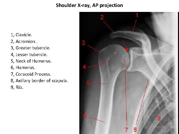 Shoulder X-ray, AP projection 1, Clavicle. 2, Acromion. 3, Greater tubercle. 4, Lesser tubercle.