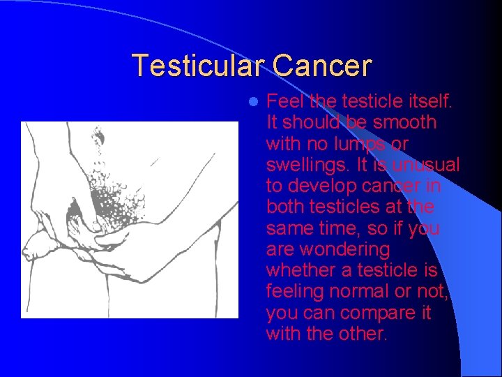 Testicular Cancer l Feel the testicle itself. It should be smooth with no lumps